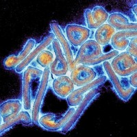 Microscopy of Marburg Virus